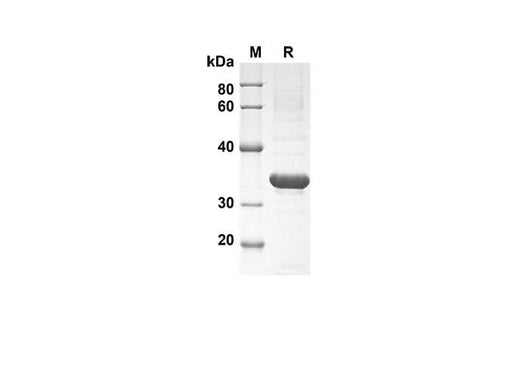 SDS-PAGE analysis of Rat IL-21 proteins , 2 μg/lane of Recombinant Rat IL-21 proteins was resolved with SDS-PAGE under reducing conditions , showing bands at 35 kDa.