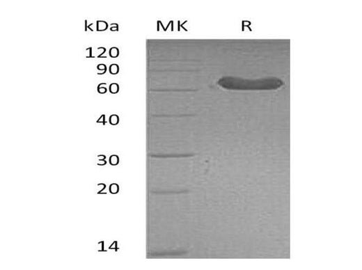 Recombinant Mouse LTBR/TNFRSF3 Protein (Fc Tag) - ABMIUM