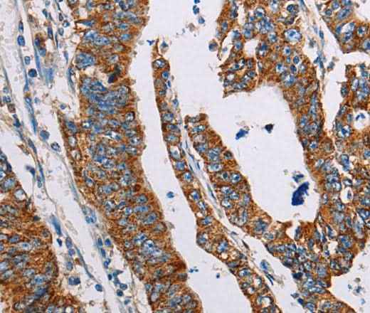 Anti-Human/Mouse ALG2 Antibody - ABMIUM