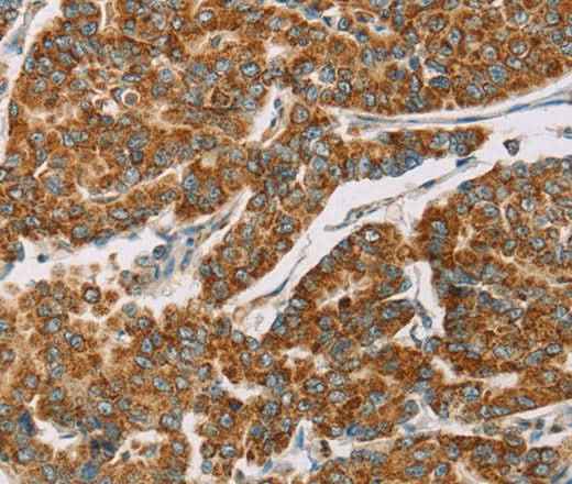 Anti-Human/Mouse DLL4 Antibody