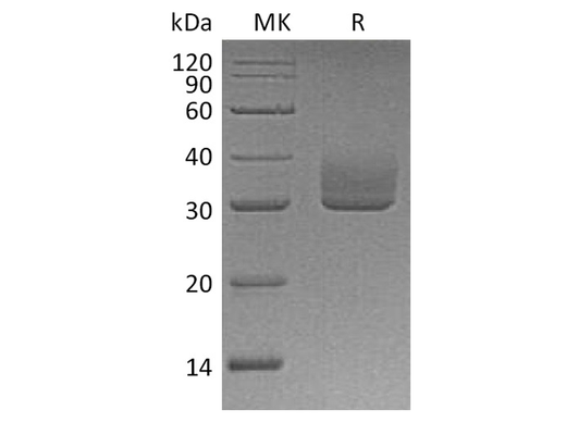 Recombinant Human ANGPTL3 Protein (His Tag) - ABMIUM