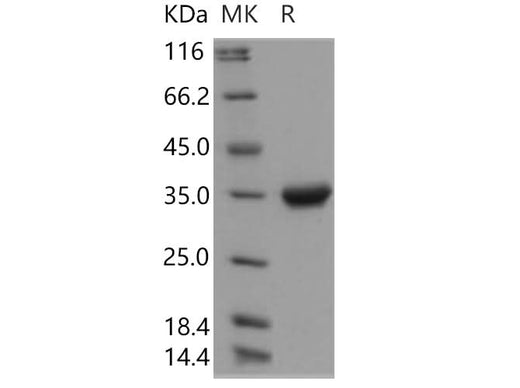 Recombinant Human IgG4-Fc Protein (108 Ser/Pro) - ABMIUM