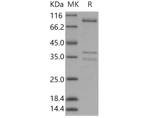 > 94 % as determined by reducing SDS-PAGE.