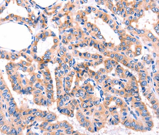 Anti-Human/Mouse/Rat ADRBK1 Antibody - ABMIUM
