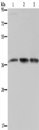 Anti-Human/Mouse CAB39 Antibody - ABMIUM