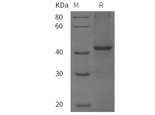 SDS-PAGE analysis of Rat CD5 / Cluster of Differentiation 5 proteins, 2 μg/lane of Recombinant Rat CD5 / Cluster of Differentiation 5 proteins was resolved with SDS-PAGE under reducing conditions, showing bands at 42 kDa.