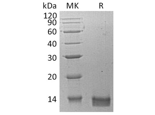 Recombinant Human CXCL14 Protein - ABMIUM