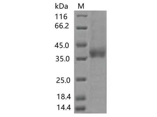 > 85 % as determined by reducing SDS-PAGE.