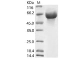Recombinant HCoV-OC43 Hemagglutinin esterase Protein (His Tag) - ABMIUM