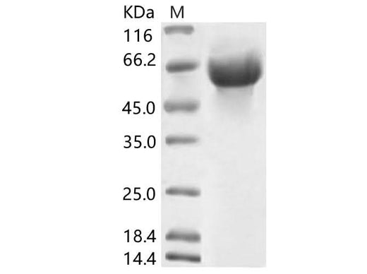 Recombinant HCoV-OC43 Hemagglutinin esterase Protein (His Tag) - ABMIUM