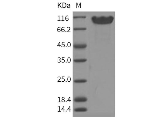 Recombinant Human NCAM1 Protein (ECD, His Tag) - ABMIUM