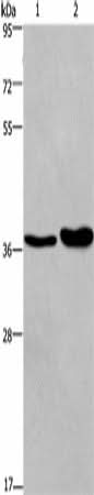 Anti-Human FUT1 Antibody - ABMIUM
