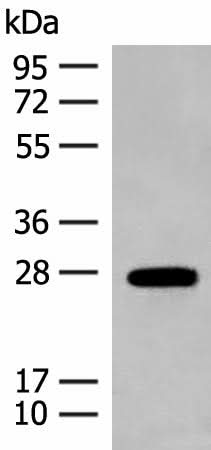 Anti-Human/Mouse GUCA1B Antibody - ABMIUM