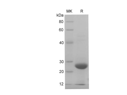 SDS-PAGE analysis of Rat S100B proteins, 2 μg/lane of Recombinant Rat S100B proteins was resolved with SDS-PAGE under reducing conditions, showing bands at 28 kDa.