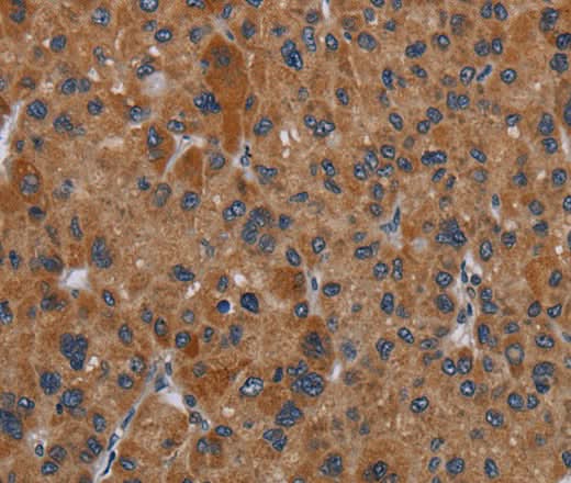 Anti-Human/Mouse OMG Antibody - ABMIUM