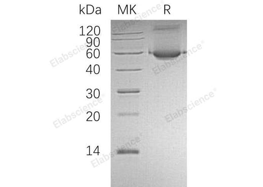 Recombinant Human ALDH1A1/ALDC Protein (His Tag) - ABMIUM
