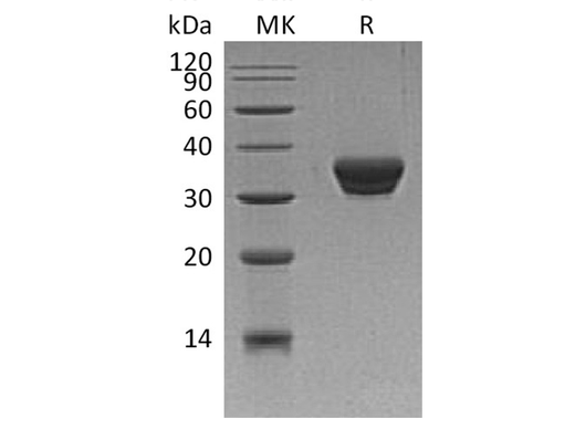Recombinant Human ASAM Protein (His Tag) - ABMIUM