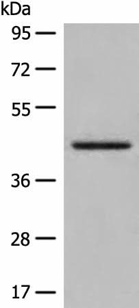 Western blot analysis of Human kidney tissue lysate using DHRS7 Polyclonal Antibody at dilution of 1:400