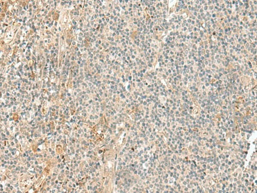 Immunohistochemistry of paraffin-embedded Human tonsil tissue using NGEF Polyclonal Antibody at dilution of 1:35(×200)