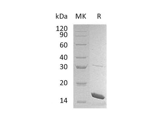 Recombinant Mouse Interleukin-36b/IL-36b Protein - ABMIUM