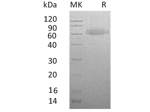 Recombinant Human RSPO3 Protein (Fc & His Tag) - ABMIUM
