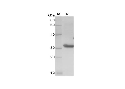 SDS-PAGE analysis of Rat IL-4 proteins, 2 μg/lane of Recombinant Rat IL-4 proteins was resolved with SDS-PAGE under reducing conditions, showing bands at 33 kDa.
