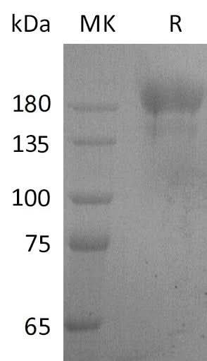 Recombinant SARS-CoV S-trimer Protein (C-6His) - ABMIUM
