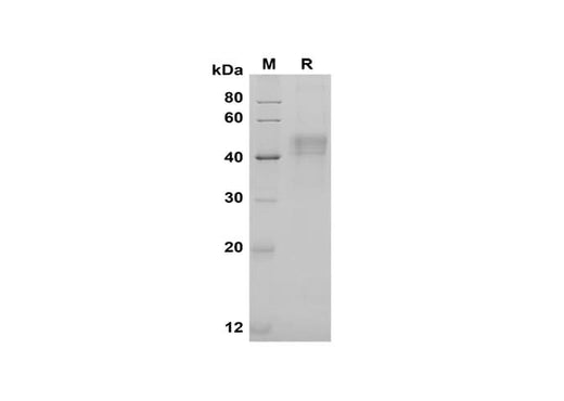 SDS-PAGE analysis of Human Pentraxin 3/TSG-14 proteins, 2 μg/lane of Recombinant Human Pentraxin 3/TSG-14 proteins was resolved with SDS-PAGE under reducing conditions, showing bands at 45 kDa.