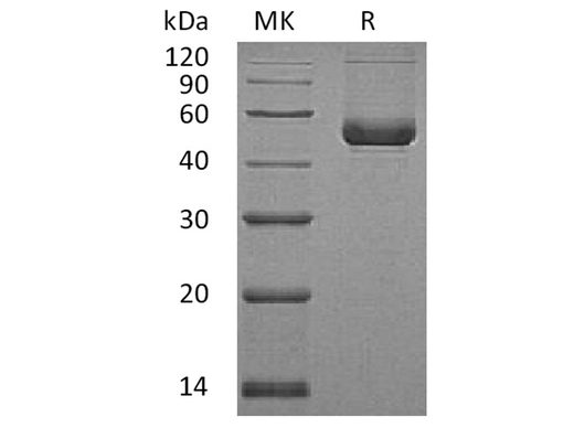 Recombinant Human SerpinE2/SERPINE2 Protein (His Tag) - ABMIUM