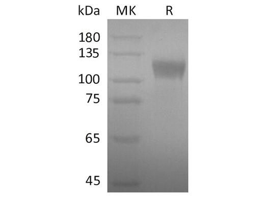 Recombinant SARS-CoV-2 S1 Protein - ABMIUM