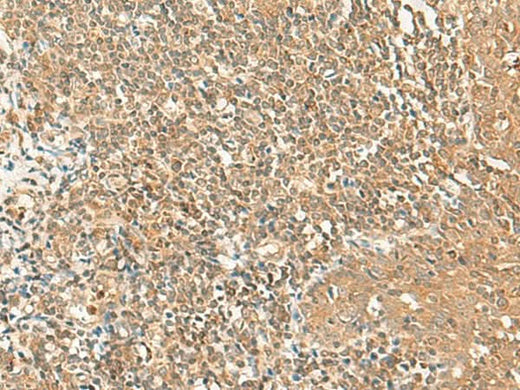 Immunohistochemistry of paraffin-embedded Human tonsil tissue using GRIPAP1 Polyclonal Antibody at dilution of 1:50(×200)