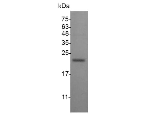 Recombinant Mouse IFN alpha 1a protein(His Tag) - ABMIUM