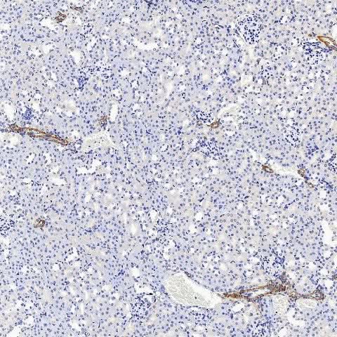 Immunohistochemistry (antigen was repair with 0.4% pepsin for 20 min) analysis of paraffin-embedded Mouse kidney using COL1A1 Polyclonal Antibody at dilution of 1:500.
