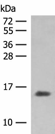 Western blot analysis of Human plasma solution using HBG1:HBG2 Polyclonal Antibody at dilution of 1:250