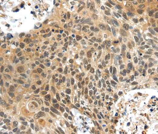 Anti-Human PLIN3 Antibody
