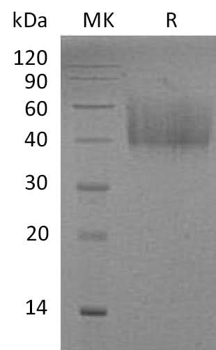 Recombinant Mouse ICOS Ligand/ICOSL Protein (His Tag) - ABMIUM