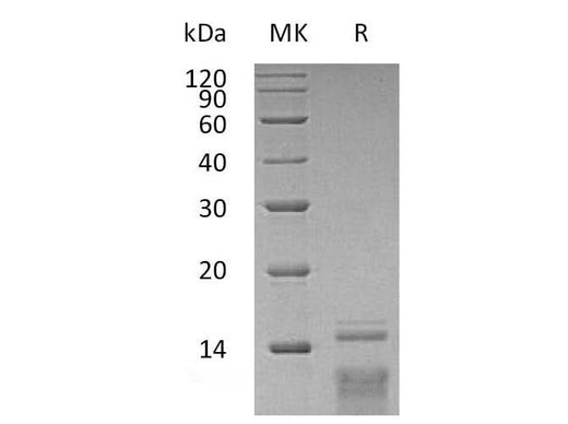 Recombinant Human TSLP Protein - ABMIUM