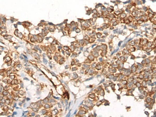 Anti-Human CA5B Antibody - ABMIUM