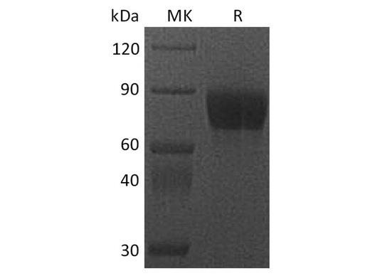 Recombinant Cynomolgus CSF1R/CD115 Protein (Fc Tag) - ABMIUM