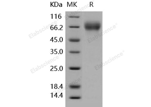 Recombinant Human SerpinF2/SERPINF2 Protein (His Tag) - ABMIUM