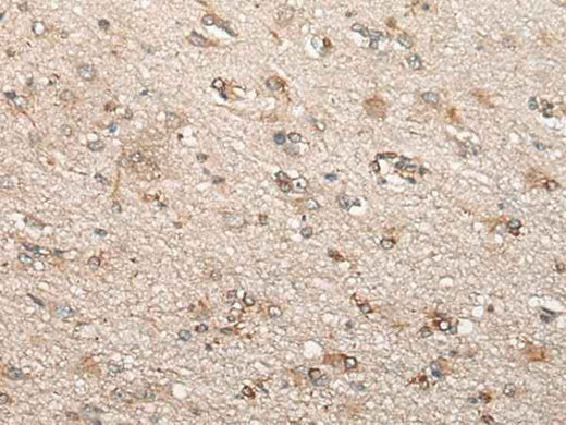Anti-Human/Mouse BCHE Antibody