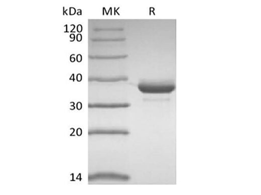 Recombinant Human CD81 (N-FC) - ABMIUM