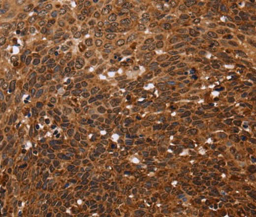 Anti-Human FANCF Antibody - ABMIUM