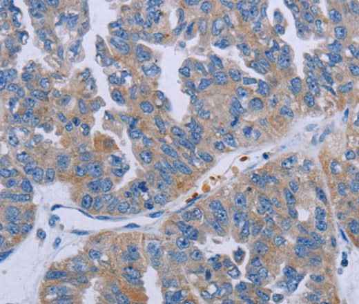 Anti-Human/Mouse/Rat P2RY2 Antibody