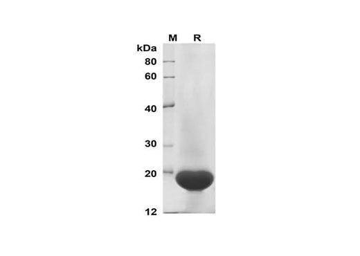 SDS-PAGE analysis of Human G-CSF/CSF3 proteins, 2 μg/lane of Recombinant Human G-CSF/CSF3 proteins was resolved with SDS-PAGE under reducing conditions, showing bands at 19 kDa.