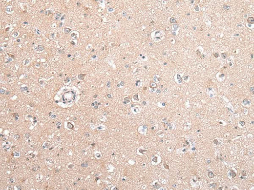 Anti-Human/Mouse/Rat GJB5 Antibody - ABMIUM