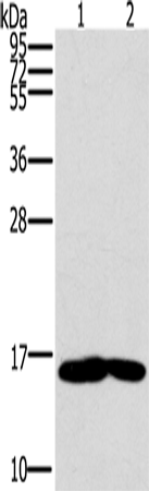 Anti-Human/Mouse/Rat MB Antibody - ABMIUM