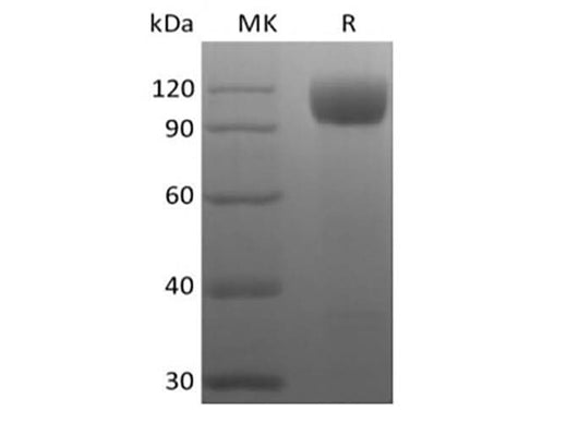 Recombinant Rhesus Macaque Angiotensin-Converting Enzyme 2/ACE-2 (C-10His) - ABMIUM
