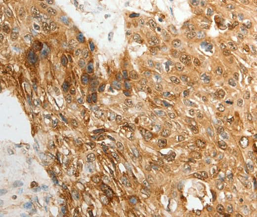 Anti-Human/Mouse TENM3 Antibody - ABMIUM