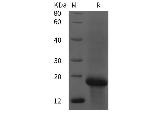 SDS-PAGE analysis of Human NOX4 proteins, 2 μg/lane of Recombinant Human NOX4 proteins was resolved with SDS-PAGE under reducing conditions, showing bands at 18 kDa.